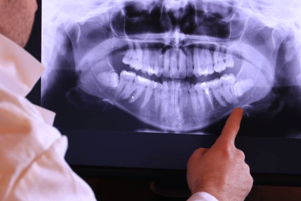Best Emergency Root Canal Treatment in Senoia, GA